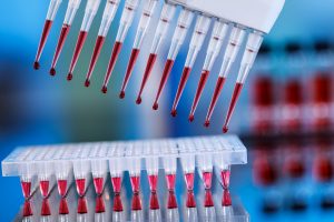 multipipette and sample tray biotech concept