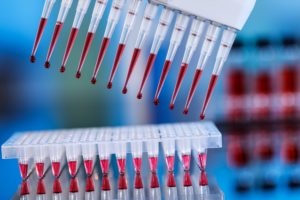 multipipette and sample tray biotech concept