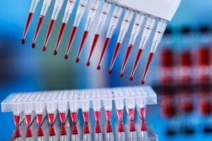 multipipette and sample tray biotech concept